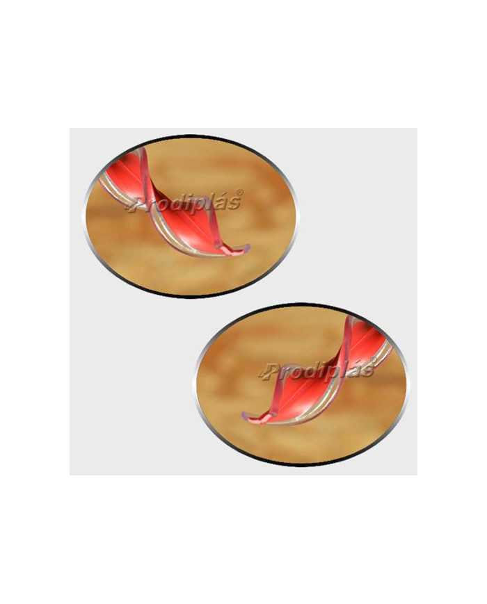 Matiz 1,10x2,00_Nº617